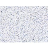 Immunohistochemistry - Anti-gamma Histone H2A.X Antibody (A295244) - Antibodies.com
