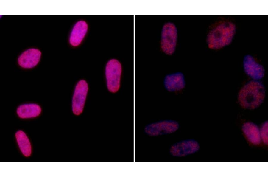 Immunocytochemistry - Anti-gamma Histone H2A.X Antibody (A295244) - Antibodies.com