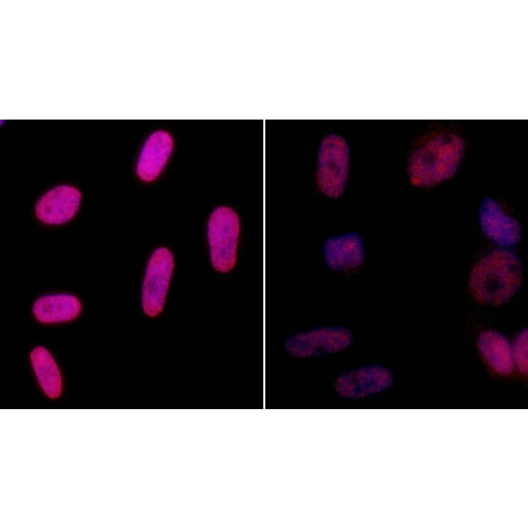 Immunocytochemistry - Anti-gamma Histone H2A.X Antibody (A295244) - Antibodies.com