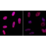 Immunocytochemistry - Anti-gamma Histone H2A.X Antibody (A295244) - Antibodies.com