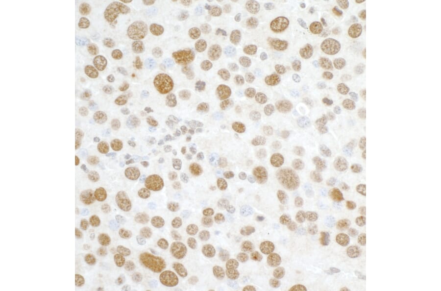 Immunohistochemistry - Anti-Histone H2A.X Antibody (A295246) - Antibodies.com