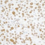 Immunohistochemistry - Anti-Histone H2A.X Antibody (A295246) - Antibodies.com