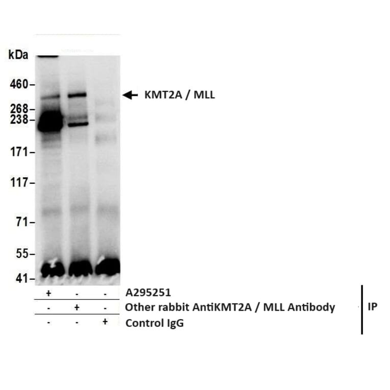 Immunoprecipitation - Anti-KMT2A / MLL Antibody (A295251) - Antibodies.com