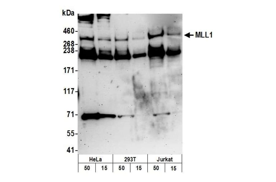 Western Blot - Anti-KMT2A / MLL Antibody (A295251) - Antibodies.com