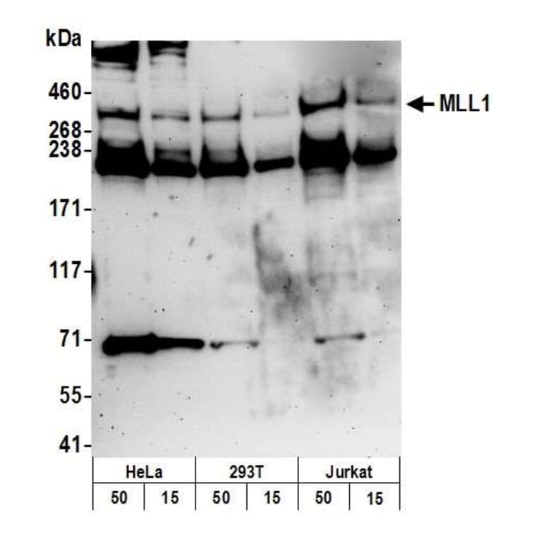 Western Blot - Anti-KMT2A / MLL Antibody (A295251) - Antibodies.com
