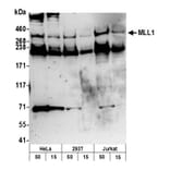 Western Blot - Anti-KMT2A / MLL Antibody (A295251) - Antibodies.com