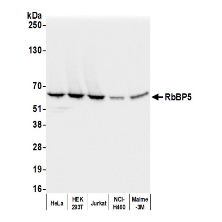 Western Blot - Anti-RbBP5 Antibody (A295267) - Antibodies.com