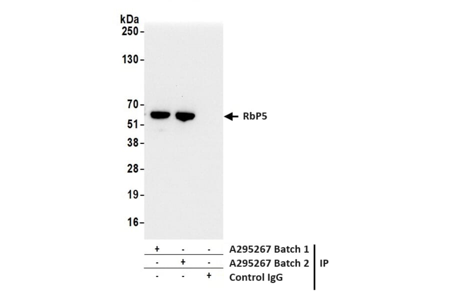 Immunoprecipitation - Anti-RbBP5 Antibody (A295267) - Antibodies.com