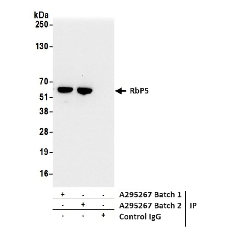 Immunoprecipitation - Anti-RbBP5 Antibody (A295267) - Antibodies.com