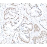 Immunohistochemistry - Anti-RbBP5 Antibody (A295267) - Antibodies.com