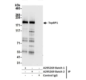Immunoprecipitation - Anti-TopBP1 Antibody (A295269) - Antibodies.com