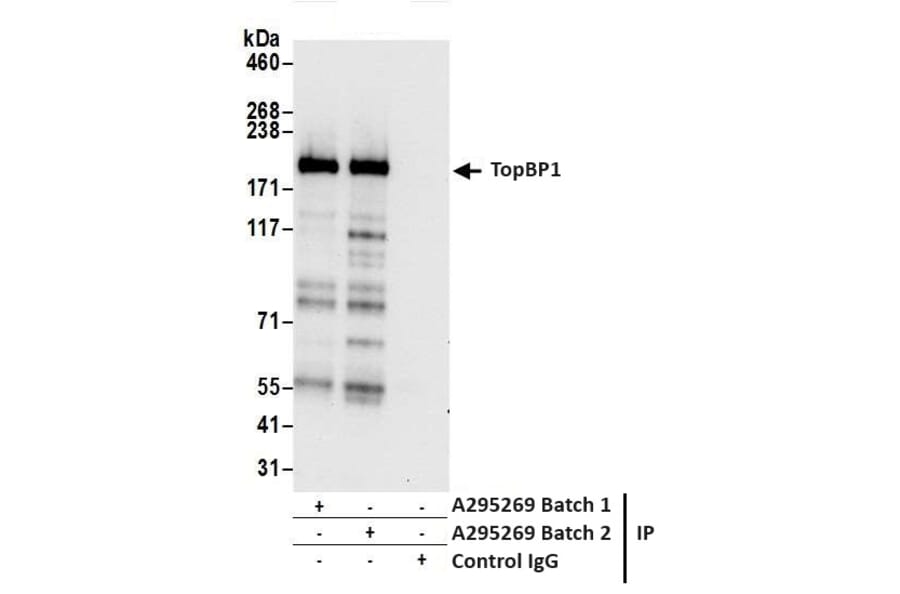 Immunoprecipitation - Anti-TopBP1 Antibody (A295269) - Antibodies.com