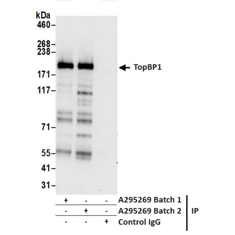 Immunoprecipitation - Anti-TopBP1 Antibody (A295269) - Antibodies.com