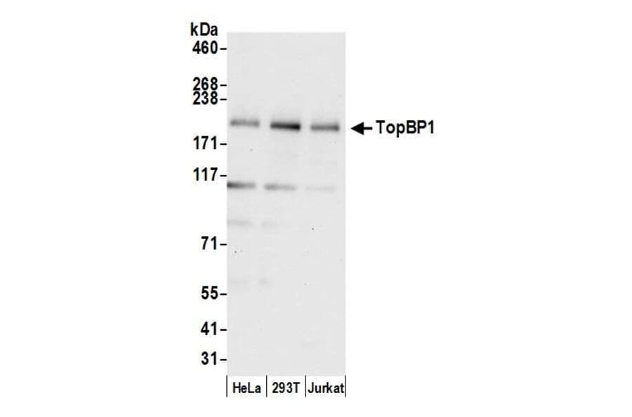 Western Blot - Anti-TopBP1 Antibody (A295269) - Antibodies.com