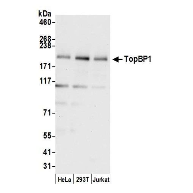 Western Blot - Anti-TopBP1 Antibody (A295269) - Antibodies.com