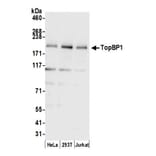 Western Blot - Anti-TopBP1 Antibody (A295269) - Antibodies.com