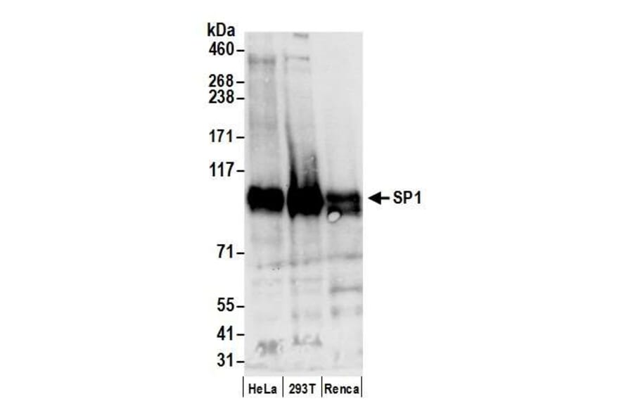 Western Blot - Anti-SP1 Antibody (A295285) - Antibodies.com