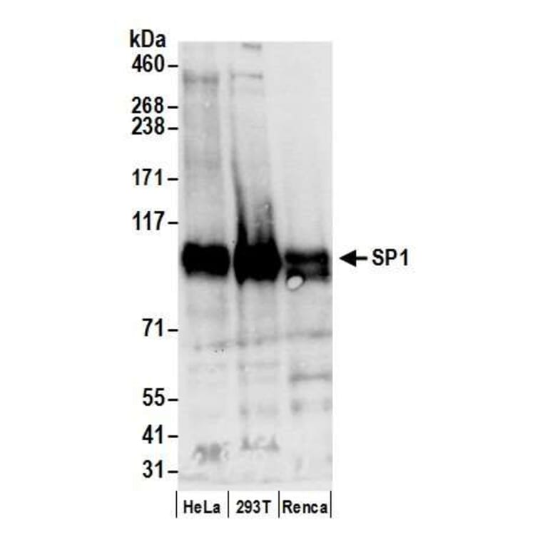 Western Blot - Anti-SP1 Antibody (A295285) - Antibodies.com