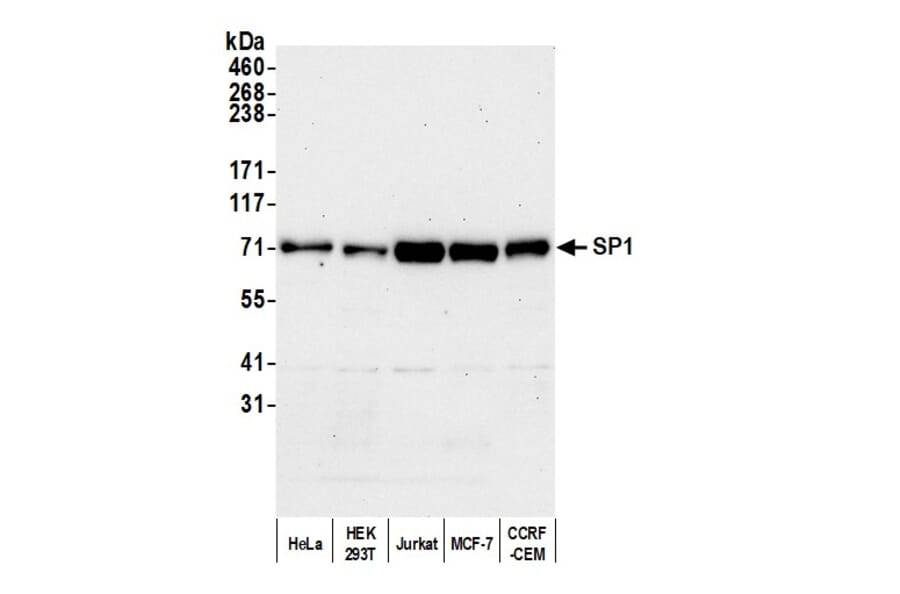 Western Blot - Anti-SP1 Antibody (A295285) - Antibodies.com