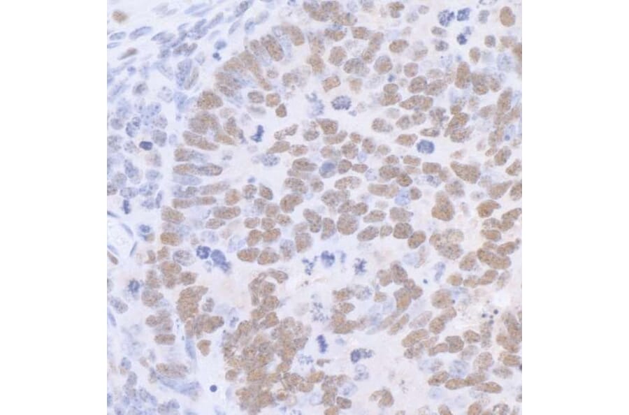 Immunohistochemistry - Anti-SP1 Antibody (A295285) - Antibodies.com