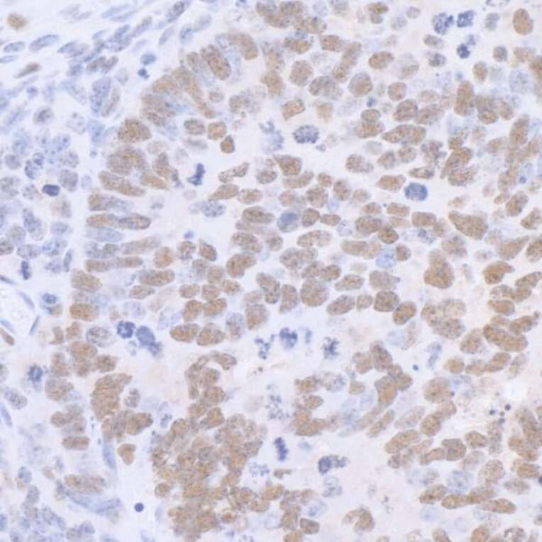 Immunohistochemistry - Anti-SP1 Antibody (A295285) - Antibodies.com