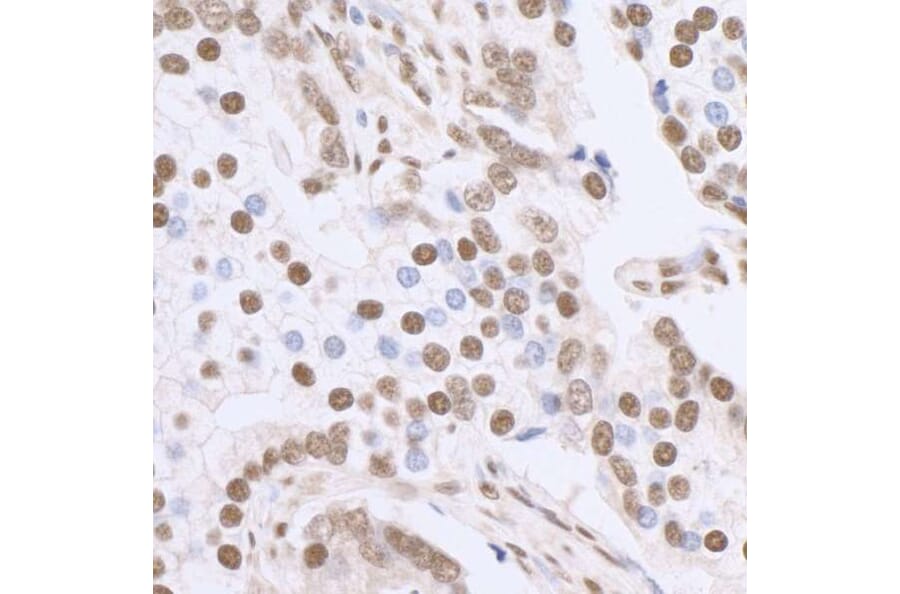 Immunohistochemistry - Anti-SP1 Antibody (A295285) - Antibodies.com