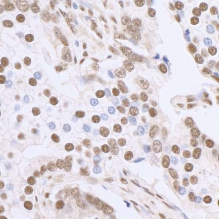 Immunohistochemistry - Anti-SP1 Antibody (A295285) - Antibodies.com