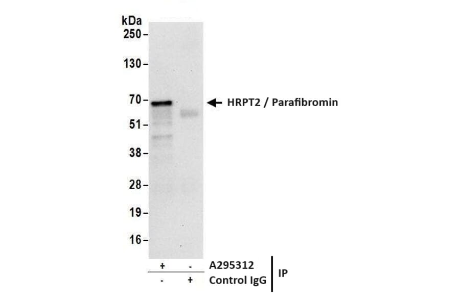 Immunoprecipitation - Anti-HRPT2 / Parafibromin Antibody (A295312) - Antibodies.com