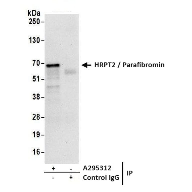 Immunoprecipitation - Anti-HRPT2 / Parafibromin Antibody (A295312) - Antibodies.com