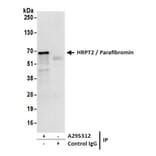 Immunoprecipitation - Anti-HRPT2 / Parafibromin Antibody (A295312) - Antibodies.com