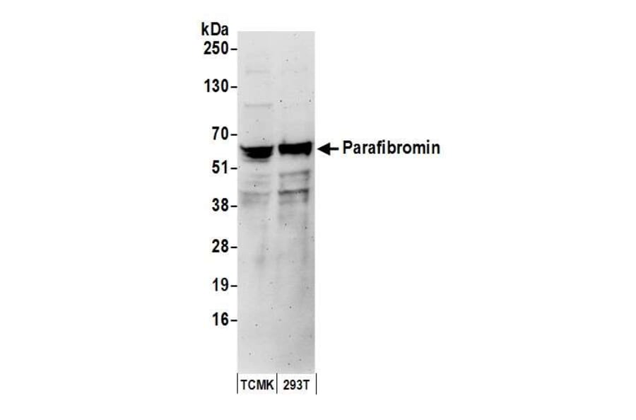 Western Blot - Anti-HRPT2 / Parafibromin Antibody (A295312) - Antibodies.com