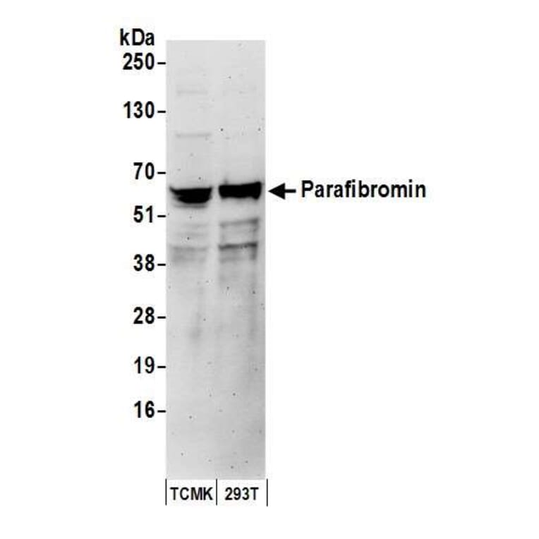 Western Blot - Anti-HRPT2 / Parafibromin Antibody (A295312) - Antibodies.com