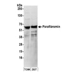 Western Blot - Anti-HRPT2 / Parafibromin Antibody (A295312) - Antibodies.com