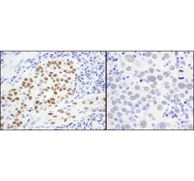 Immunohistochemistry - Anti-MCM5 Antibody (A295329) - Antibodies.com
