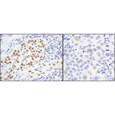 Immunohistochemistry - Anti-MCM5 Antibody (A295329) - Antibodies.com