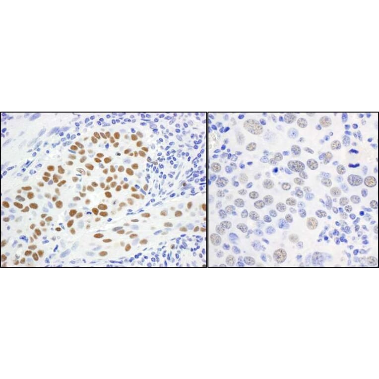 Immunohistochemistry - Anti-MCM5 Antibody (A295329) - Antibodies.com