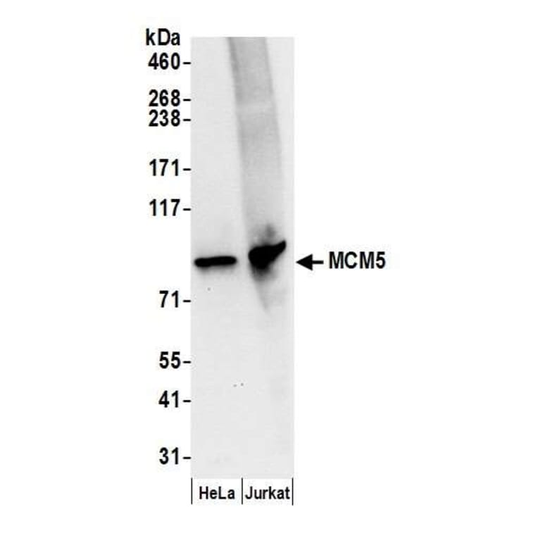 Western Blot - Anti-MCM5 Antibody (A295329) - Antibodies.com