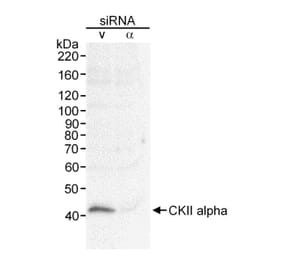 Western Blot - Anti-CSNK2A1 Antibody (A295330) - Antibodies.com