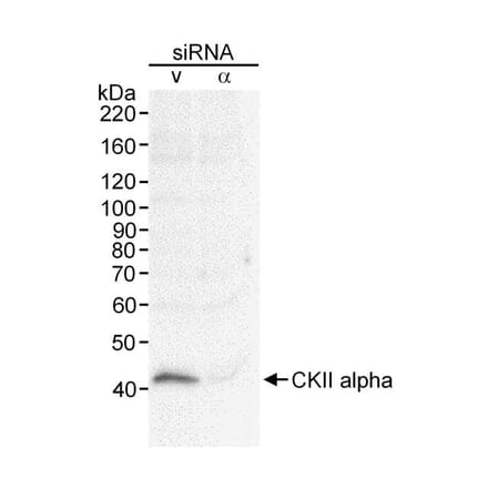 Western Blot - Anti-CSNK2A1 Antibody (A295330) - Antibodies.com