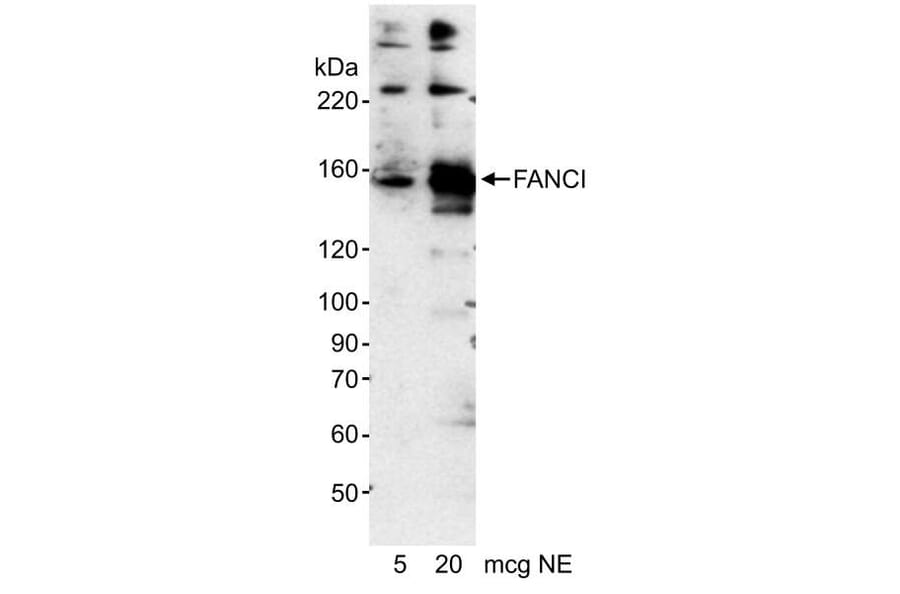 Western Blot - Anti-FANCI Antibody (A295344) - Antibodies.com