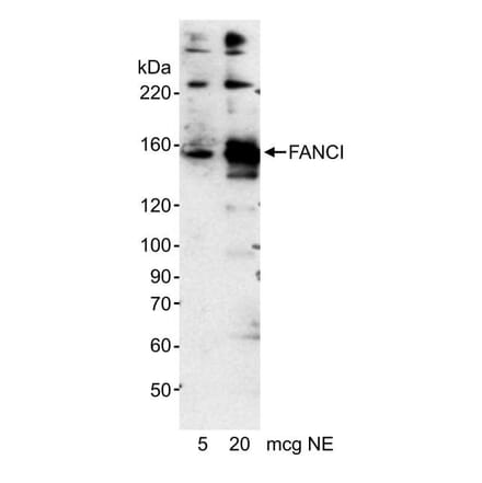 Western Blot - Anti-FANCI Antibody (A295344) - Antibodies.com