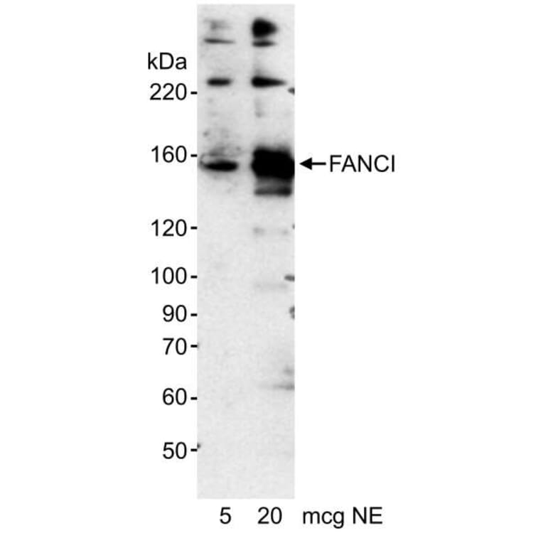 Western Blot - Anti-FANCI Antibody (A295344) - Antibodies.com