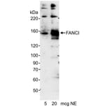 Western Blot - Anti-FANCI Antibody (A295344) - Antibodies.com