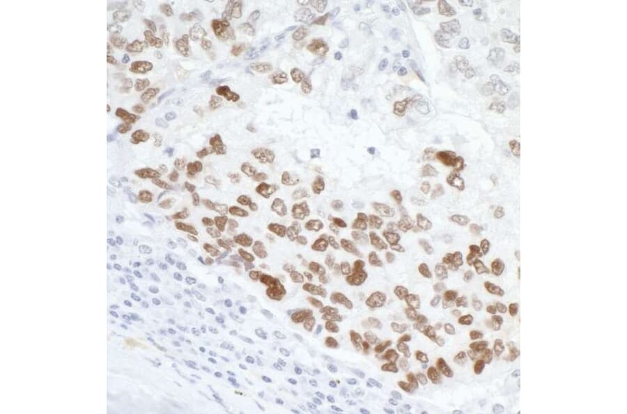 Immunohistochemistry - Anti-p53 Antibody (A295374) - Antibodies.com