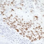 Immunohistochemistry - Anti-p53 Antibody (A295374) - Antibodies.com