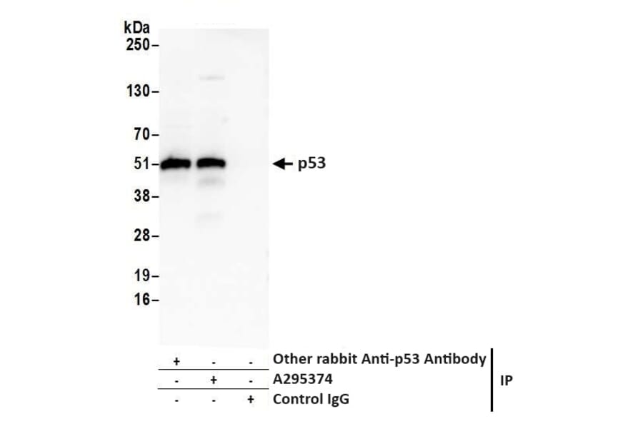 Immunoprecipitation- Anti-p53 Antibody (A295374) - Antibodies.com