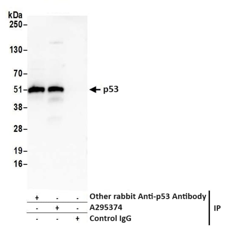 Immunoprecipitation- Anti-p53 Antibody (A295374) - Antibodies.com