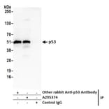 Immunoprecipitation- Anti-p53 Antibody (A295374) - Antibodies.com
