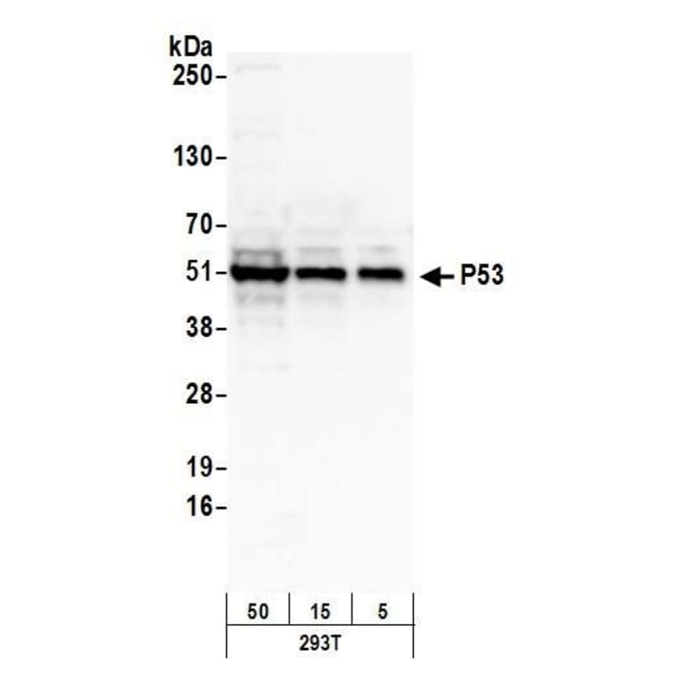 Western Blot - Anti-p53 Antibody (A295374) - Antibodies.com