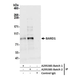 Immunoprecipitation - Anti-BARD1 Antibody (A295385) - Antibodies.com